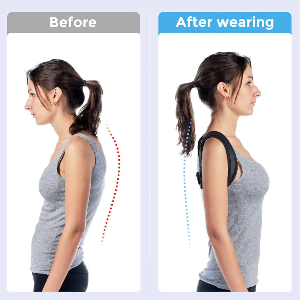 Before and after wearing a back brace on a woman's posture correction.